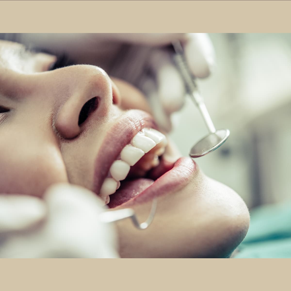 Teeth Cleaning