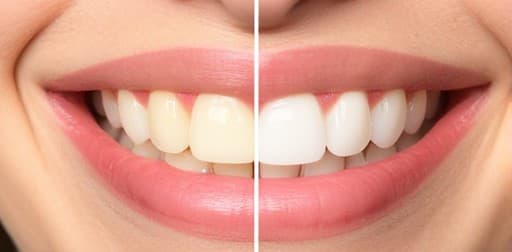 Cosmetic Dentistry